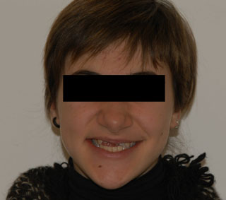 Prima del trattamento.