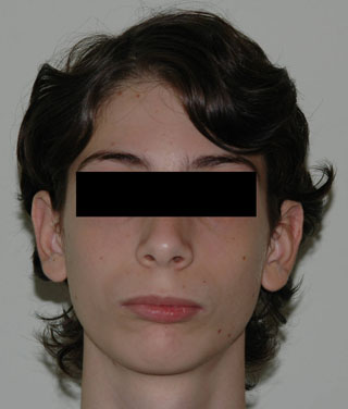 Prima del trattamento.
