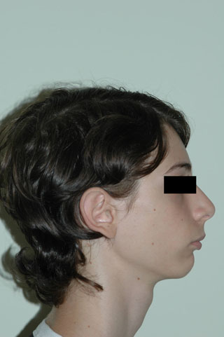 Prima del trattamento.