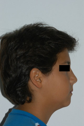 Prima del trattamento.