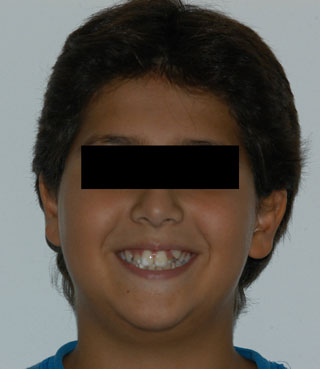 Prima del trattamento.