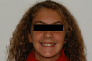 Prima del trattamento.