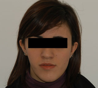 Prima del trattamento.