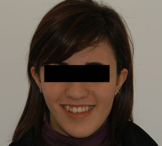 Prima del trattamento.