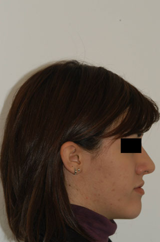Prima del trattamento.