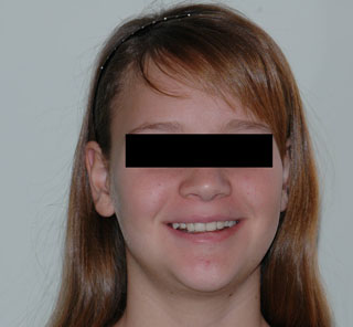 Prima del trattamento.