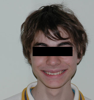 Dopo il trattamento.