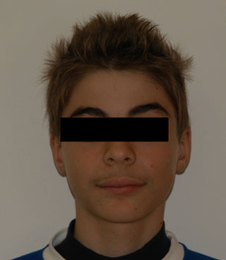Prima del trattamento.